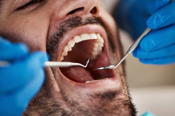 Best Pediatric Emergency Dentist in St Martin, MS